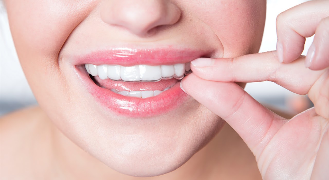 suresmile-delftse-tandartspraktijk
